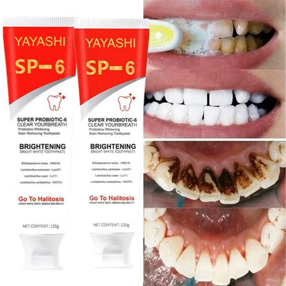 Probiotic Toothpaste SP-6 Whitening Tooth Remove Plaque Stains Teeth Whitener Oral Hygiene Clean Fresh Breath Denta 120g New Dealshavens